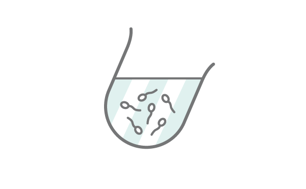 精子凍結保存・融解